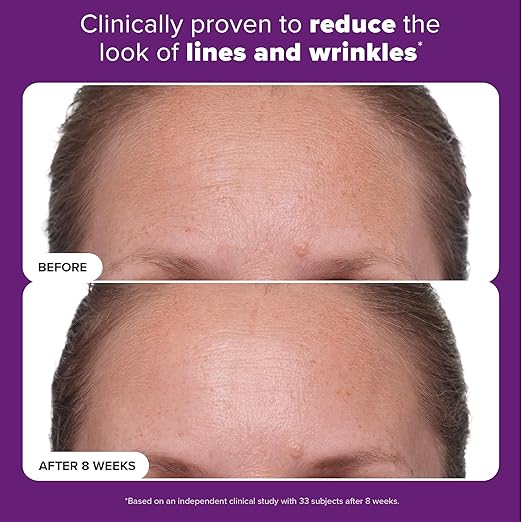 Paula's Choice CLINICAL 1% Retinol Treatment Cream: Advanced Anti-Aging Serum with Peptides, Vitamin C & Licorice Extract – For Wrinkles & Radiant Skin - Image 4