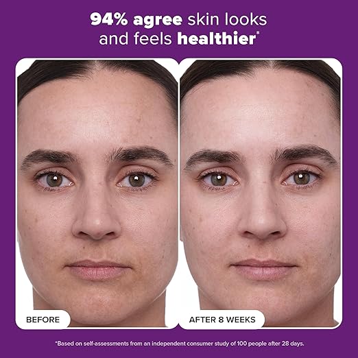 Paula's Choice CLINICAL 1% Retinol Treatment Cream: Advanced Anti-Aging Serum with Peptides, Vitamin C & Licorice Extract – For Wrinkles & Radiant Skin - Image 5