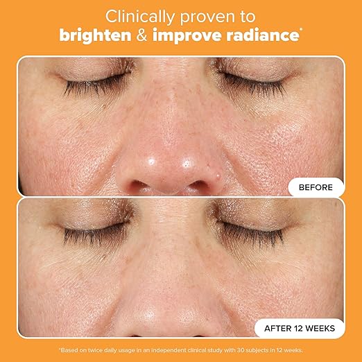 Paula's Choice BOOST C15 Super Booster, 15% Vitamin C Serum for Face, Face Serum with Vitamin E & Ferulic Acid for Discoloration & Glow, Fragrance-Free, 0.67 Fl Oz - Image 7