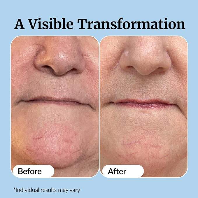 Vibriance Super C Serum for Mature Skin - All-in-One Vitamin Formula Hydrates, Firms, Lifts, Smooths, Targets Age Spots, Wrinkles, 1 fl oz - Pack of 3 - Image 6