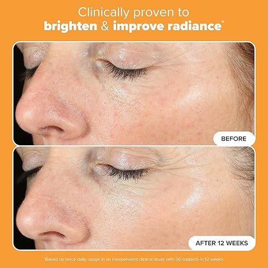 Paula's Choice BOOST C15 Super Booster, 15% Vitamin C Serum for Face, Face Serum with Vitamin E & Ferulic Acid for Discoloration & Glow, Fragrance-Free, 0.67 Fl Oz - Image 5